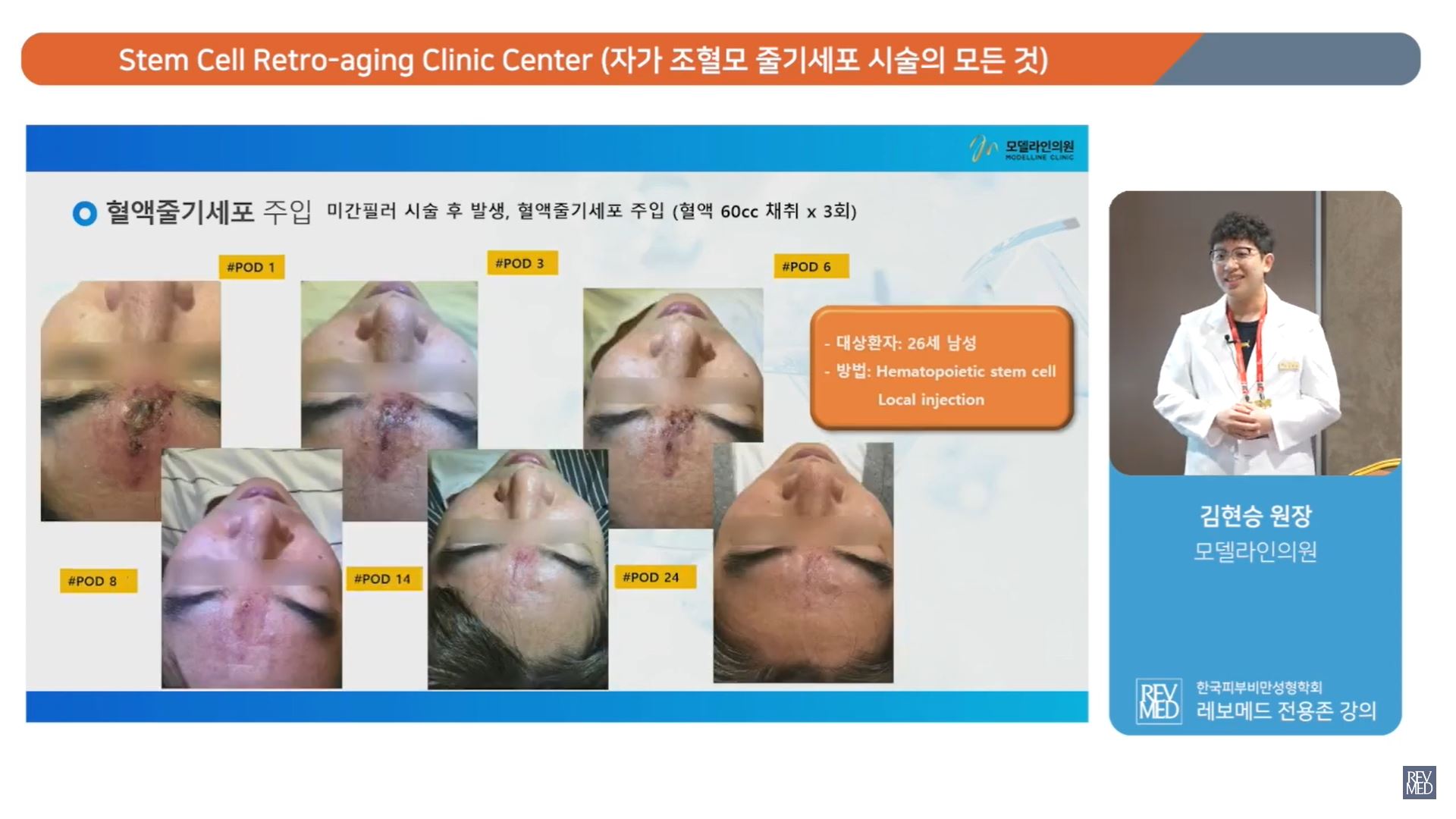 김현승 대표원장의 자가 조혈모 줄기세포 세미나 [레보메드 Key Doctor]